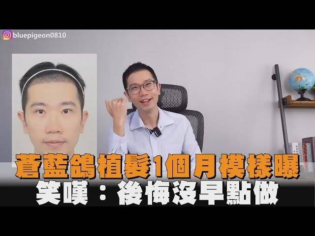 [問卦] 蒼藍鴿的髮量突然多到嚇死人???