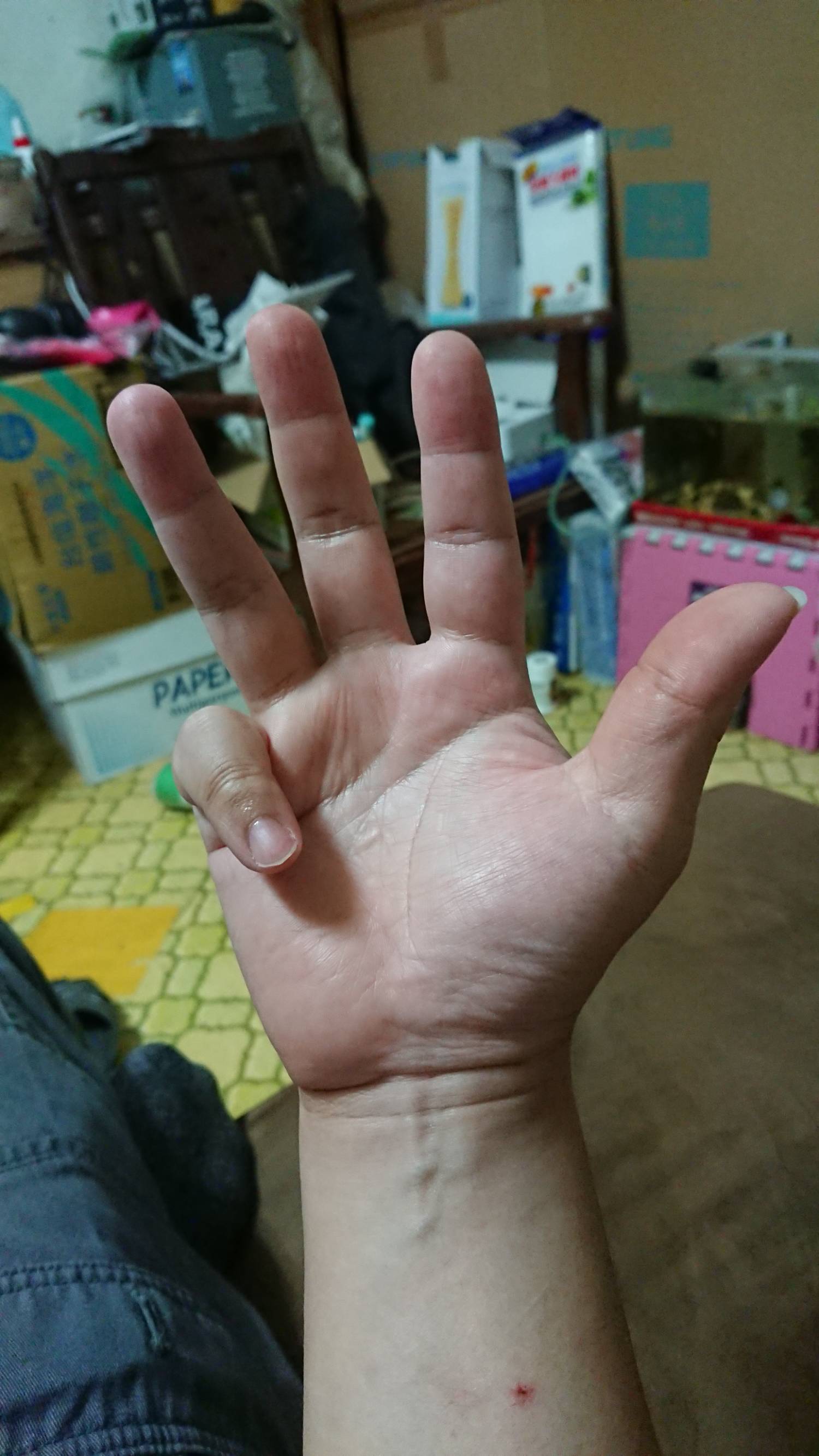 [問題] 有人能在無名指放鬆伸直的情況下彎曲小指嗎?